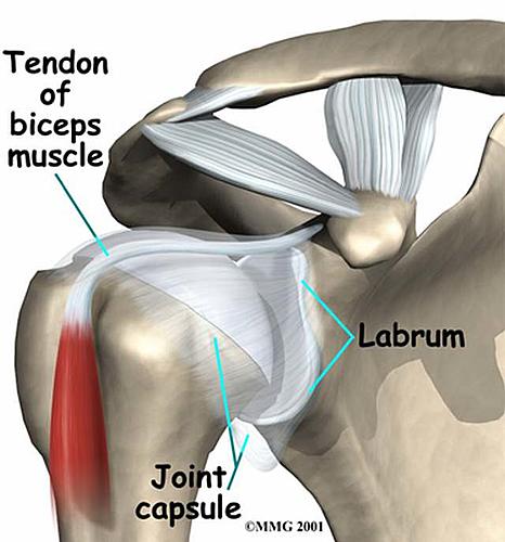 No plan, no research....Australia, here I come.-labral_tears.jpg