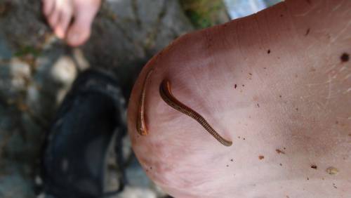 Leeches!